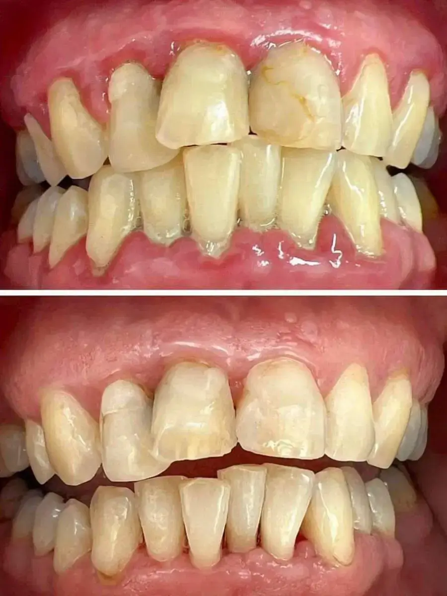 Dentální hygiena