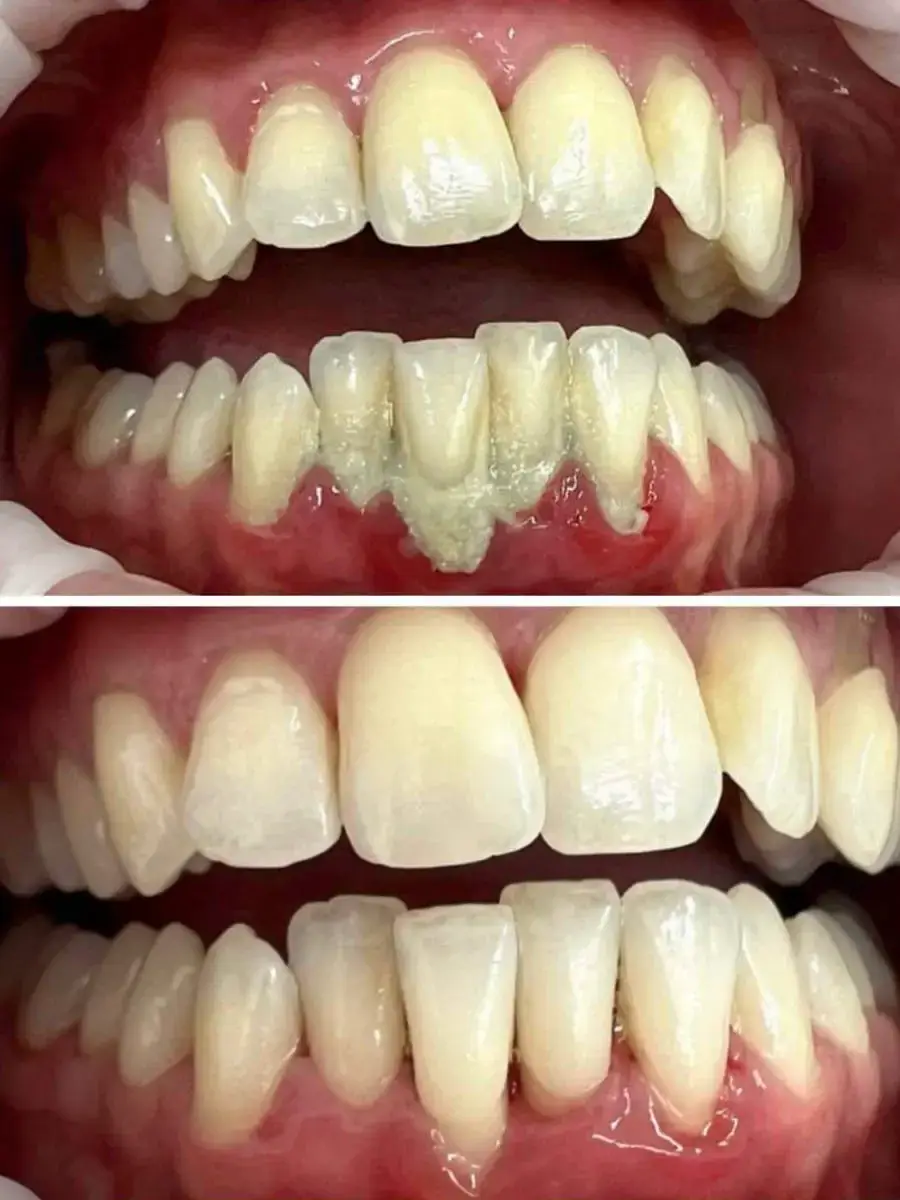Dentální hygiena