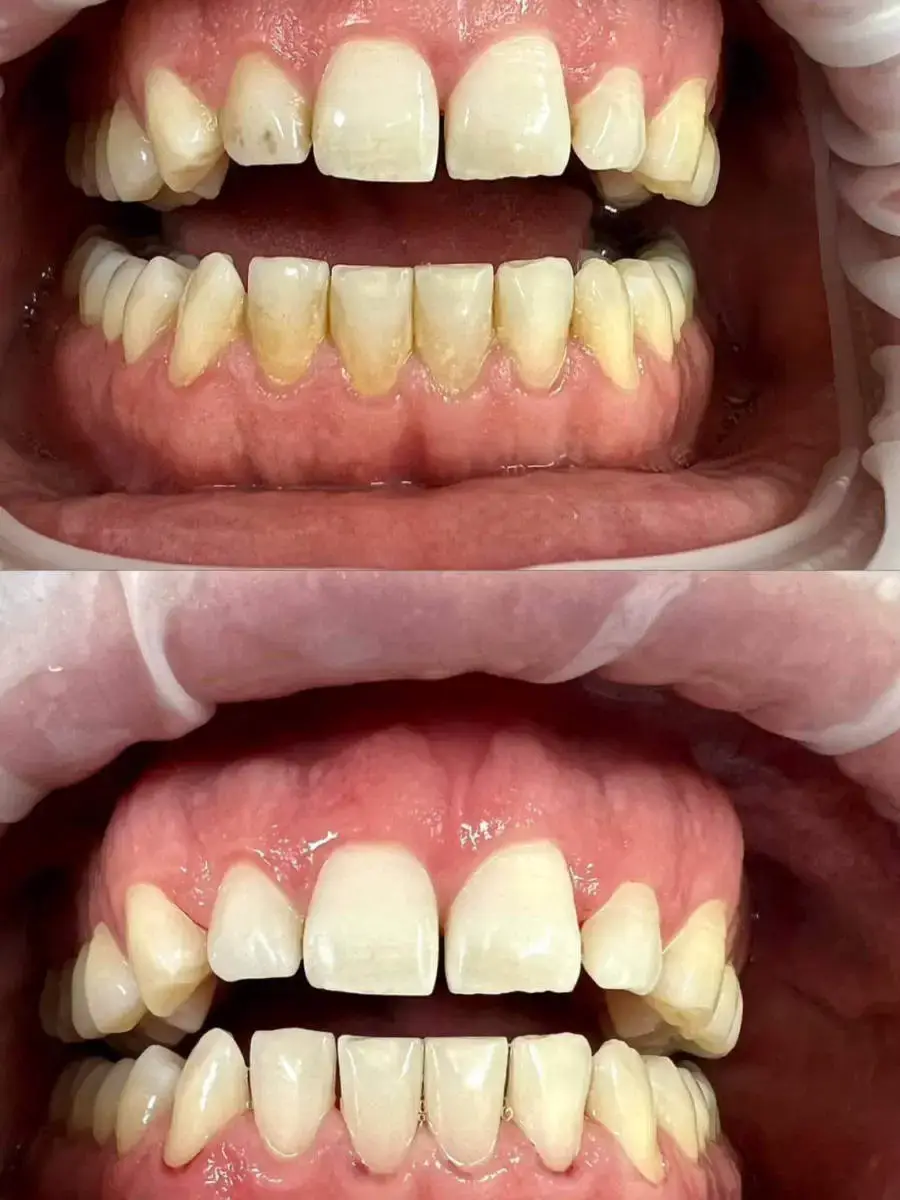 Dentální hygiena